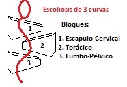 scolio 3cblocks
