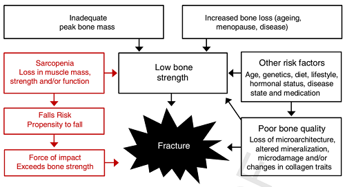 Patogenia fracturas osteoporosis - Pilates y osteoporosis.¿Es posible generar hueso nuevo?