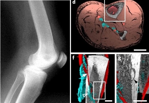 bone circulation 002 - Descubre las novedades en el sistema musculoesquelético