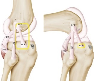 ligamento anterolateral rodilla esquema 002 - Descubre las novedades en el sistema musculoesquelético